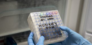 Monkeypox detected in Gauteng