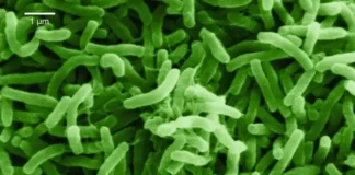 cholera bacteria