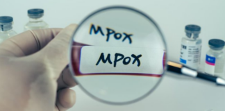 Health department calls for calm as Mpox cases rise in Gauteng