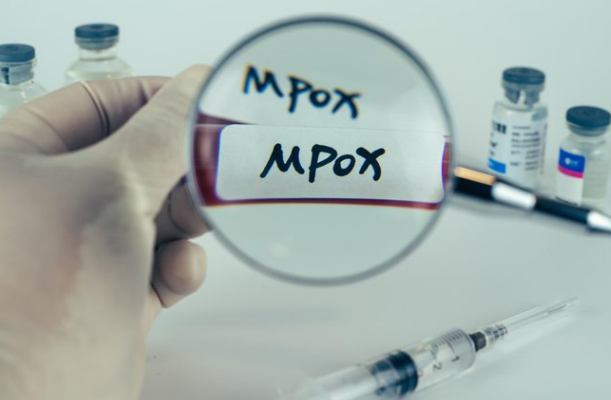 Health department calls for calm as Mpox cases rise in Gauteng
